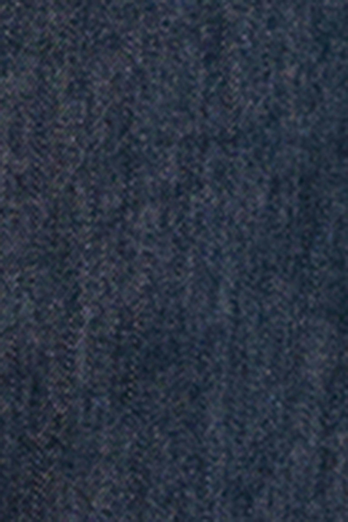 Oversized gallaskyrta