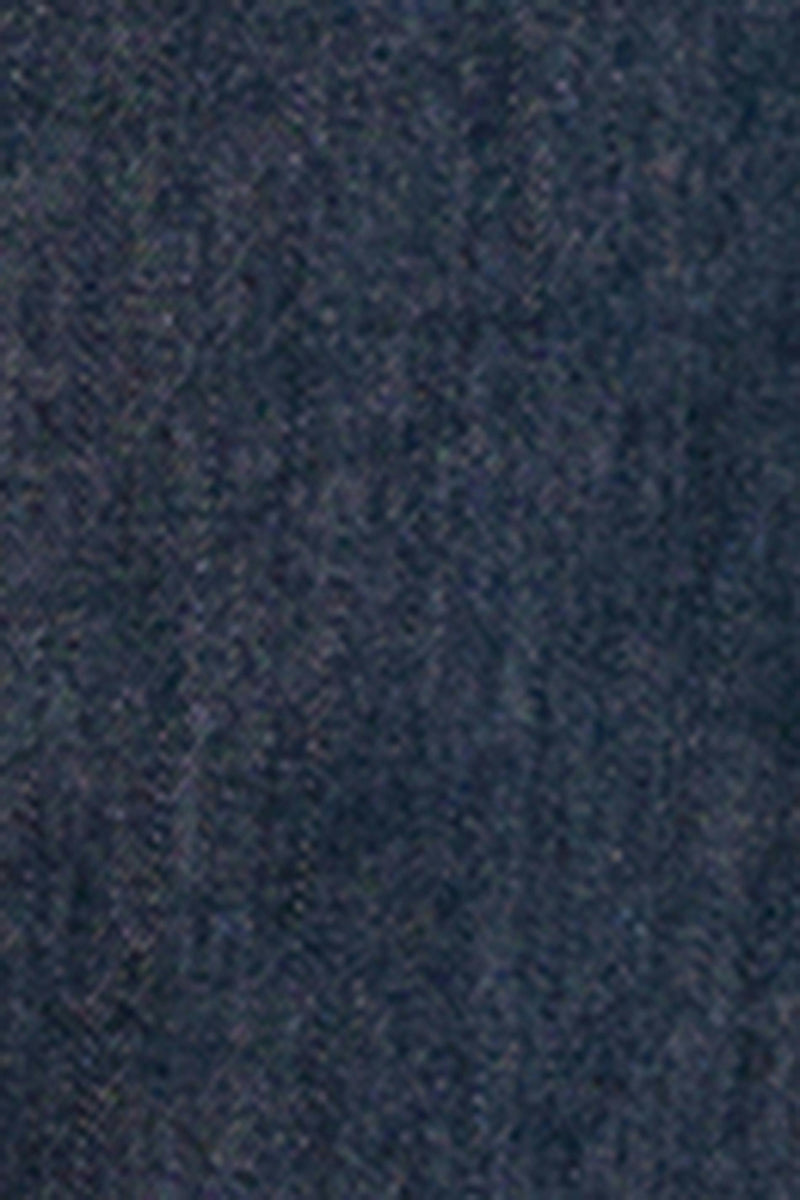 Oversized gallaskyrta